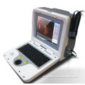 Medical Portable and Digital Ab Scan Ophthalmic Ultrasound, Medical Ultrasound, Medical Ophthalmic Instrument (6000AB)